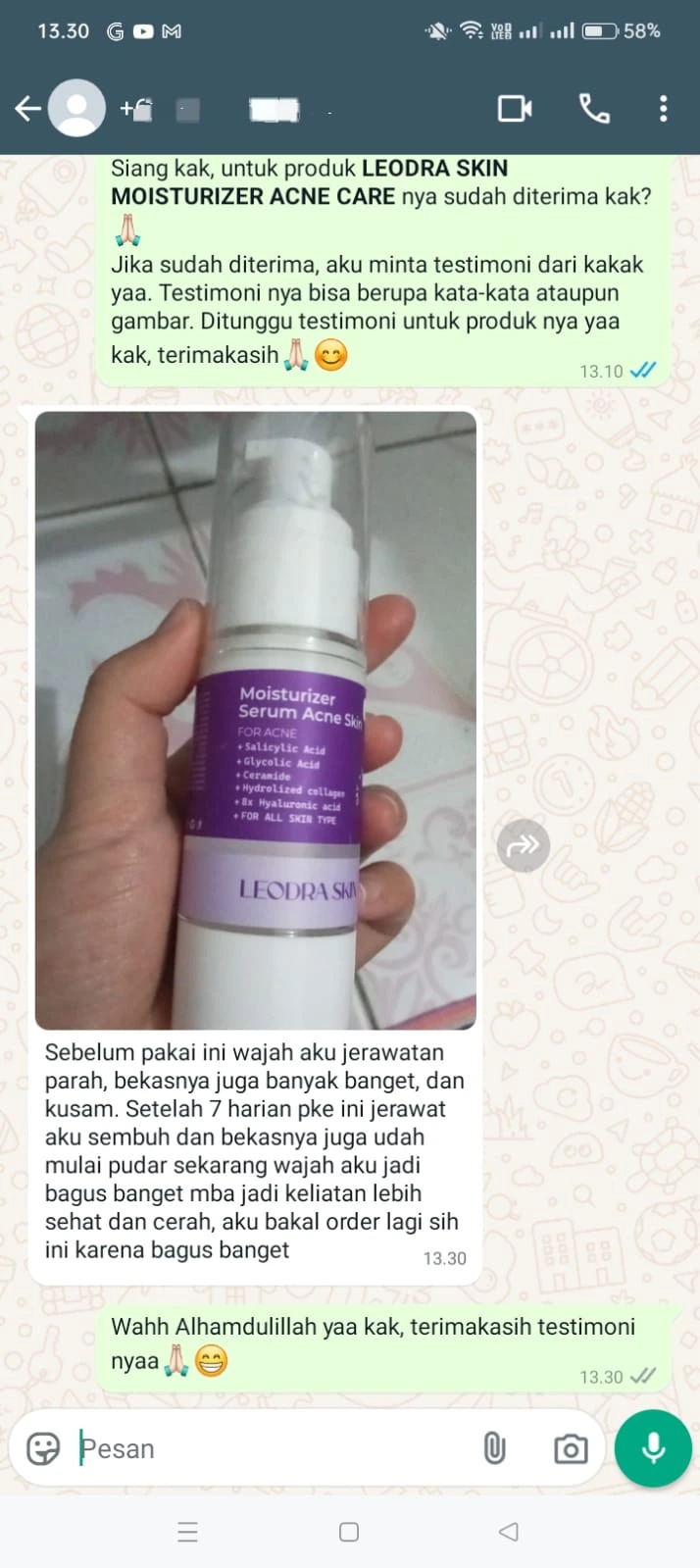 riview pelanggan leodra skin moisturizer yang meraskan kulit cerah dan tidak iritasi